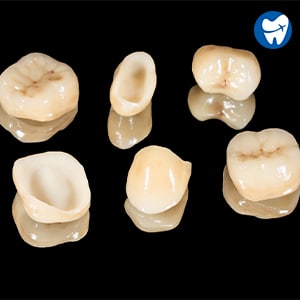 Ceramic crowns