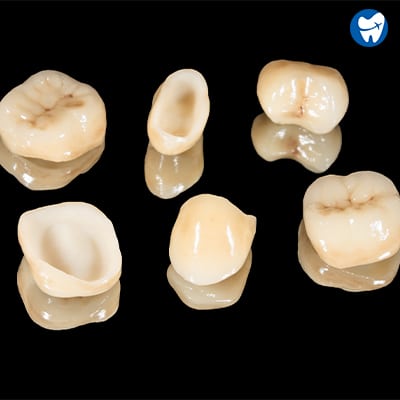 All Ceramic Crowns