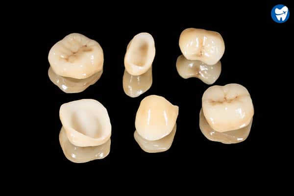 Ceramic Crowns