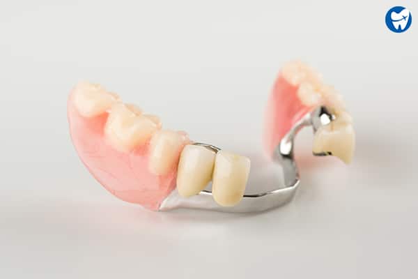 Partial Denture