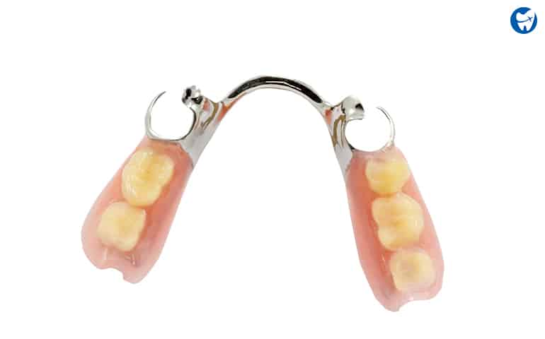 Partial Denture