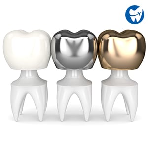 Dental Crowns in Costa Rica