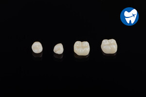 All porcelain crowns