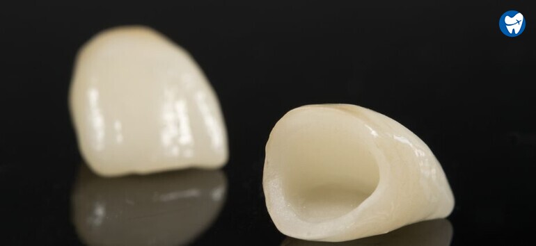 Porcelain Crowns