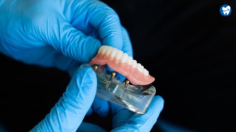 Snap on denture