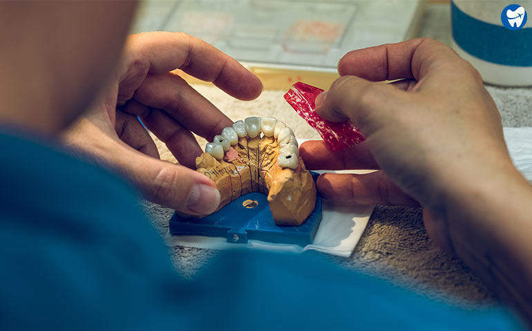 Acrylic Dentures in Los Algodones