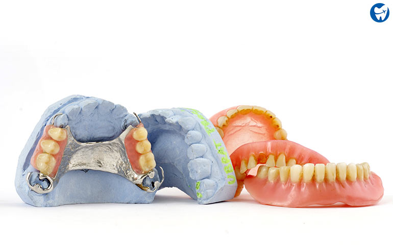 Metal Dentures | Dentures in Thailand