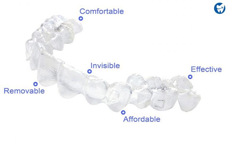 Clear Aligners 