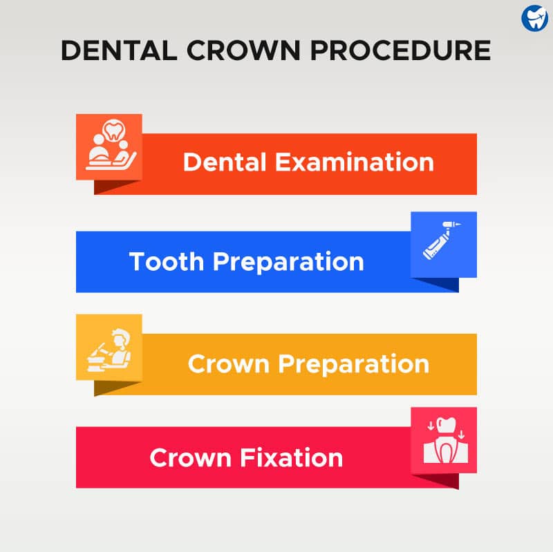 Dental Crown Procedure