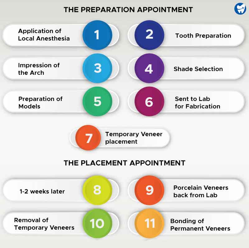 Dental veneers procedure