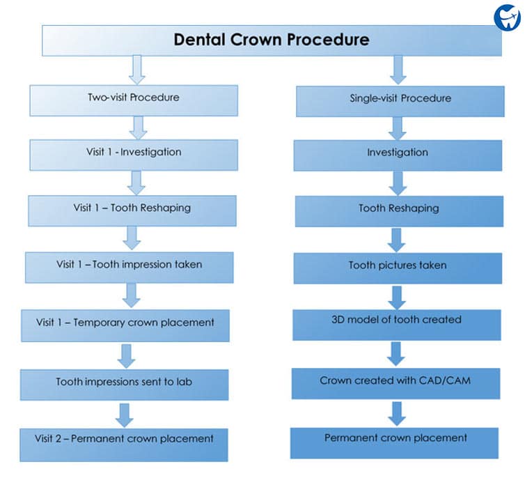 Dental Crown Procedure