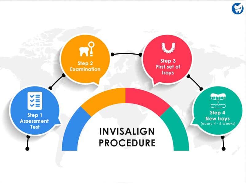 Invisalign procedures