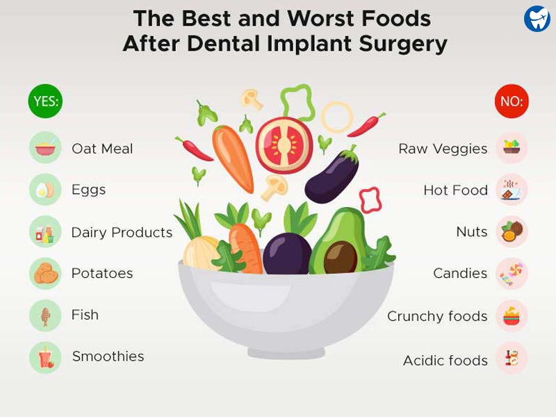 Post-Dental-Implant-Surgery-Diet