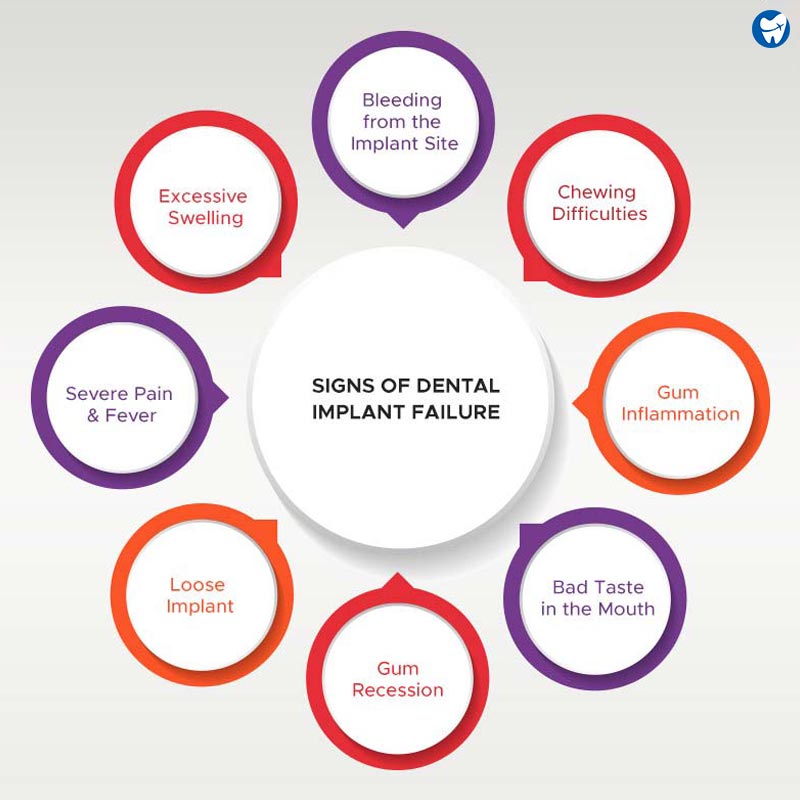 Signs of Dental Implant Failure