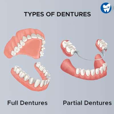 Dentures | Ciudad Juarez, Mexico