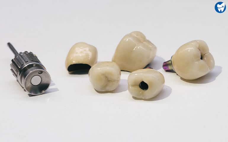 Zirconia crowns