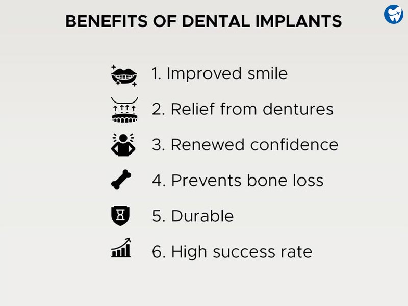 Benefits of dental implants