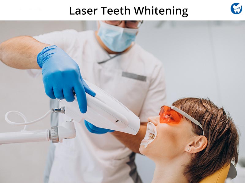 Laser Teeth Whitening