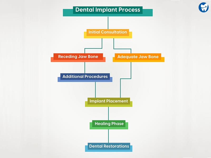 Dental implant process