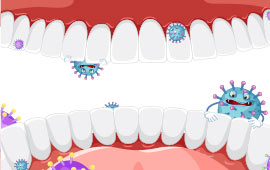 Gum Disease