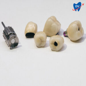 Dental Crowns