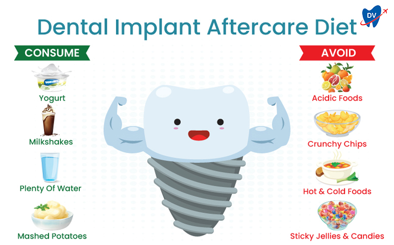 Post-Implant Surgery Diet