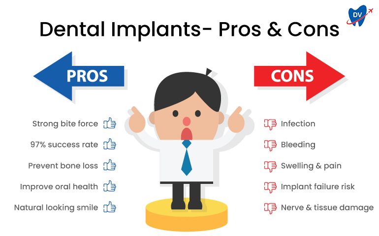 Dental Implants Pros and Cons