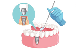 Dental Work in Ho Chi Minh City, Vietnam