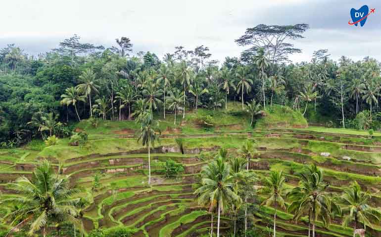 Sri Lanka dental tourism for tropical climate lovers 