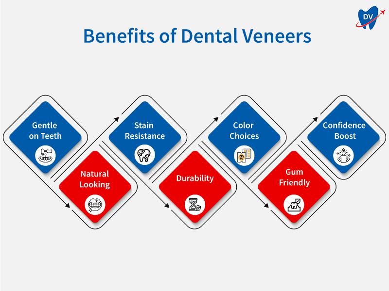 Benefits of Dental Veneers