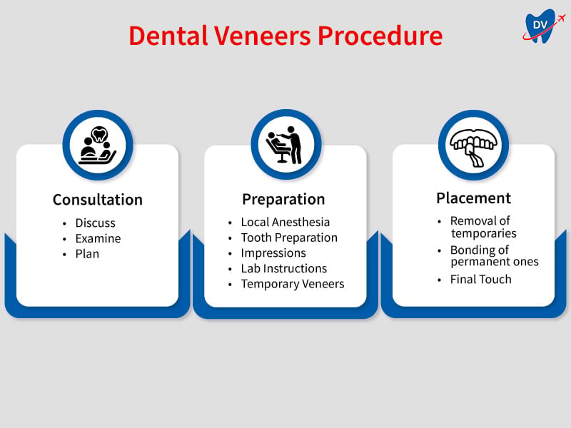 Dental veneers in Tijuana procedure