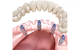 Permanent Teeth