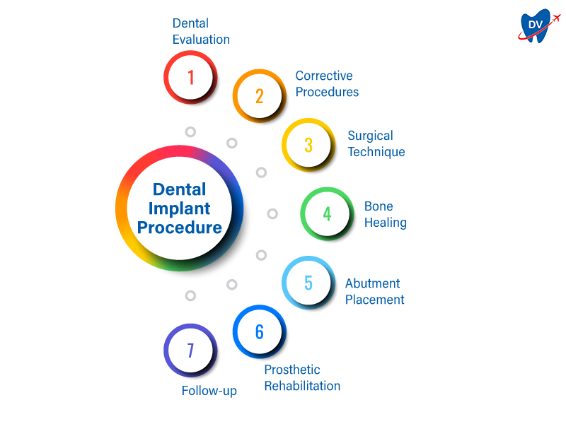 Dental Implant Procedure