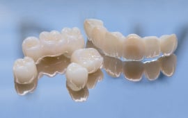 Empress-Veneers.jpg