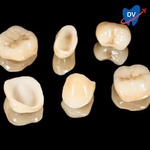 All Ceramic Crowns