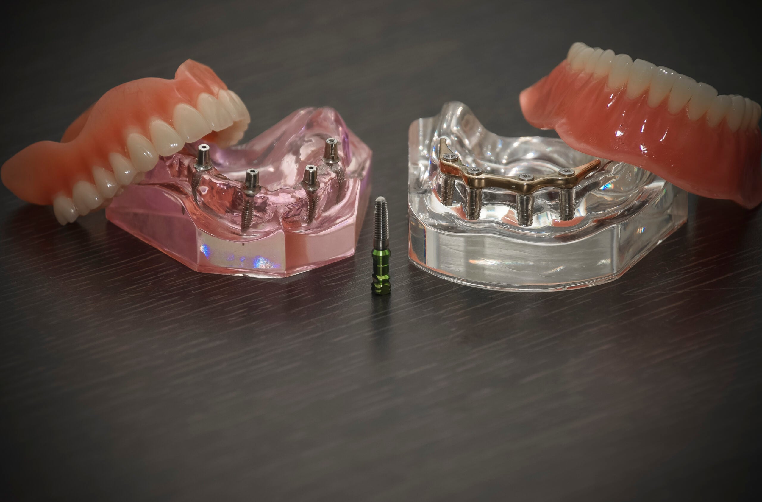 All-on-4 Dental Implant in Costa Rica at ConfiDental clinic; DentaVacation's partner clinic
